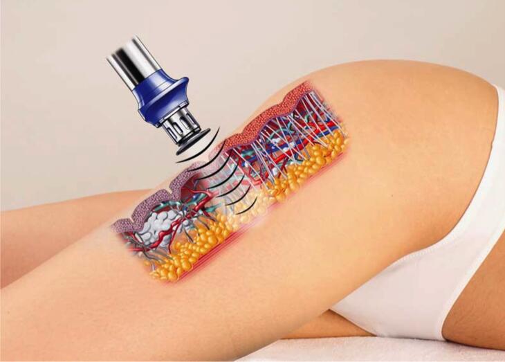 FISIOTERAPIA DERMATOFUNCIONAL 