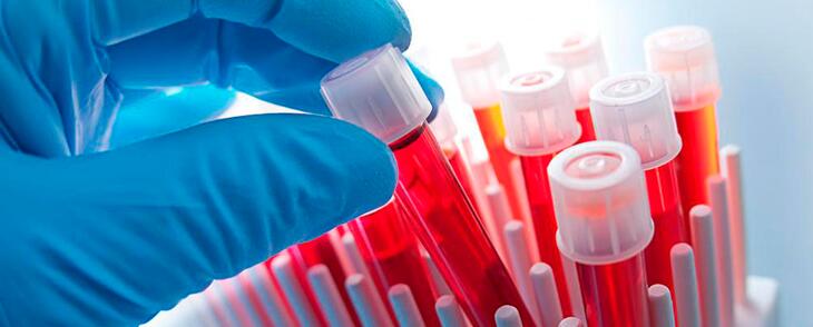 HEMATOLOGIA CLÍNICA